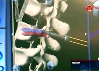 Спинальный нейрохирургический центр проводит операции на позвоночнике при помощи робототехники